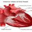 مدلسازی سیستم گردش خون در شریانها با استفاده از متد المان محدود