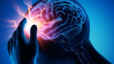 تحقیق در مورد تصويربرداری از مغز در هنگام درد