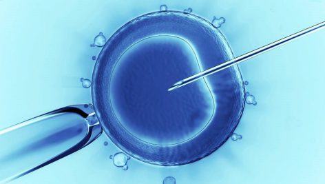 روش های ورود DNA یه درون سلول